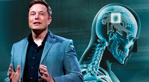 Elon Musk Anuncia La Implantación Del Primer Chip Cerebral En Un Ser Humano Revista